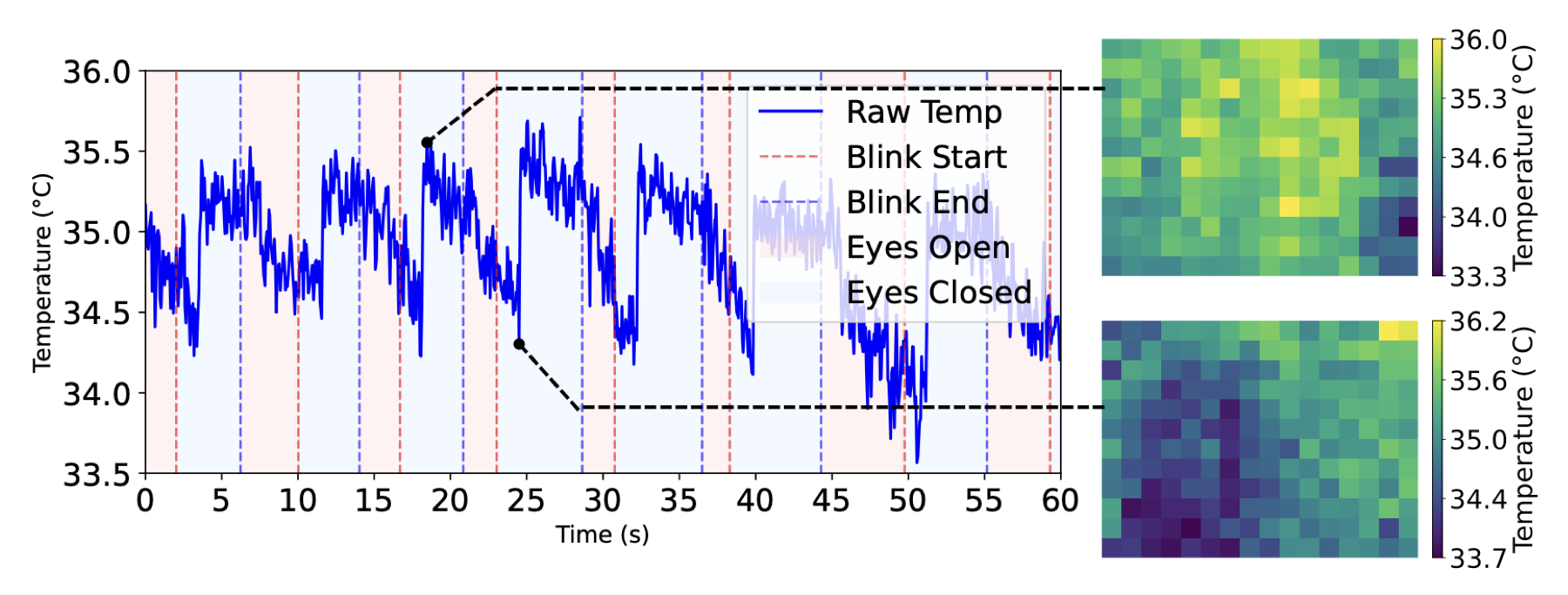 A temperature trace with blink start and end marked, and two thermal maps for eyes open and eyes closed.